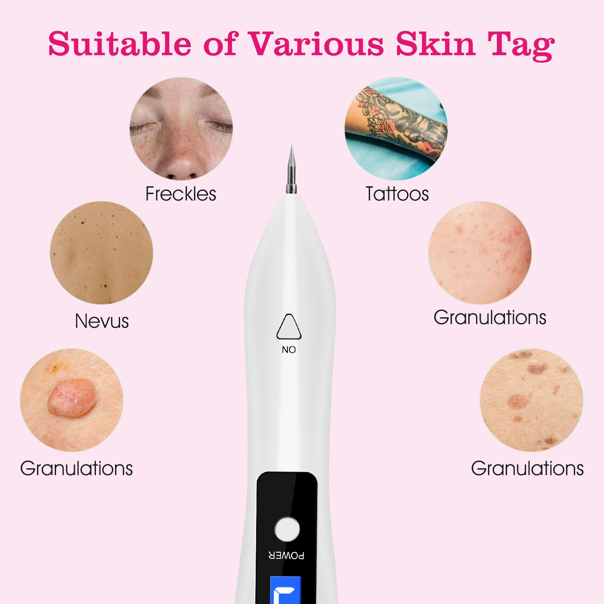 Portable Skin Tag & Blemish Remover