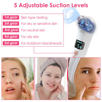 Blackhead Vacuum Remover Acne Remover